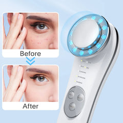 #0859 Facial Beauty Massager Skin Care Beauty Tool Face Massager Vibrating Deep Cleaning Skin Rejuvenation